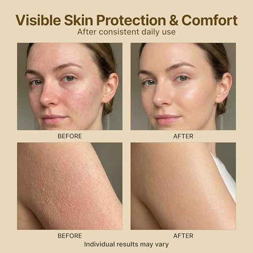 Dersie Tallow Sunscreen SPF 30 – Mineral UV Defense with Zinc Oxide