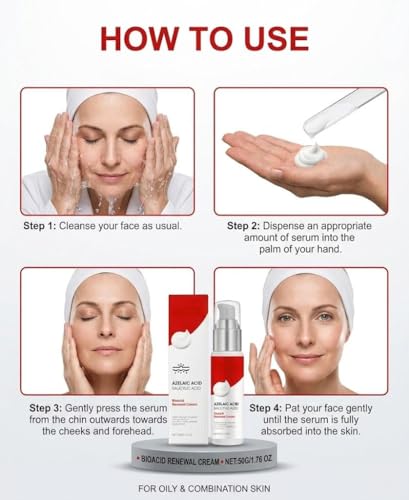 Yeardera 10% Azelaic Acid Acne Spot Treatment Cream - Soothing Moisturizer for Sensitive Skin, 1.6 oz
