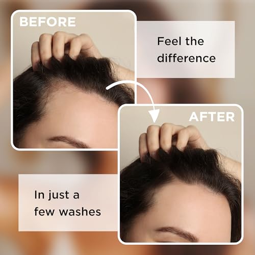 TERRAFIQUE Rice Water Shampoo Bar 3-Pack - Moisturizing Hair Growth Soap