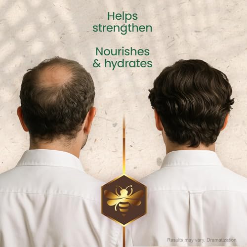 Tío Nacho Anti-Hair Loss Shampoo with Rosemary & Royal Jelly, 32 fl oz