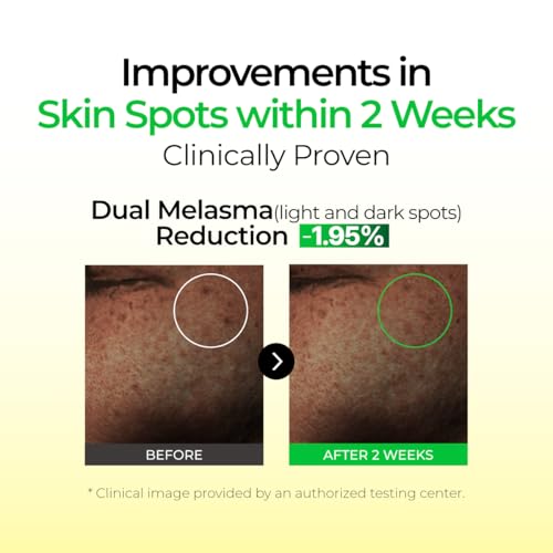IZEZE Lemon CNA Serum | Dark Spot Correcting & Illuminating 1.01 fl. oz