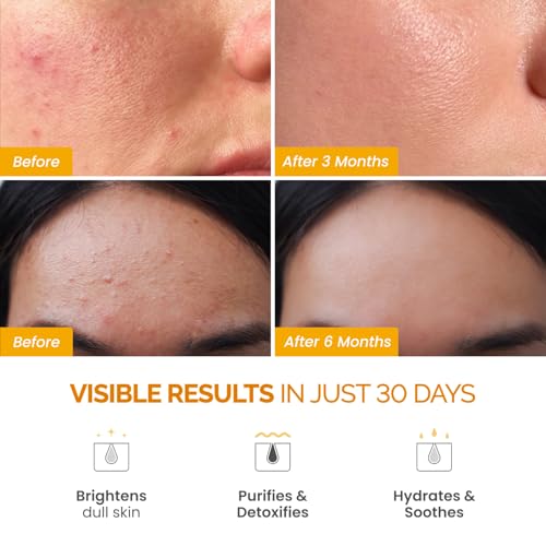 Bushbalm Ingrown Hair Routine - Roller Rescue, Nude Oil and Nude Scrub Bundle - AHA & BHA - Exfoliating, Soothing, Cooling for Intimate Areas, Underarms - Helps With Razor Bumps, Ultimate(Trio Bundle)