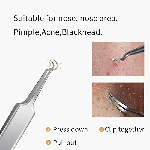 FIXBODY Stainless Steel Blackhead & Splinter Remover Tool Kit - Pimple, Ingrown Hair, Acne, Comedone Extraction Tweezers