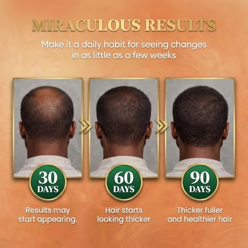 Batana Oil for Hair Growth Dr Sebi, 100% Raw Organic Batana Hair Mask from Honduras, Wild Growth Hair Oil, Scalp Oil Promotes Hair Thickness, Prevents Loss for Men & Women, 4.06 fl oz