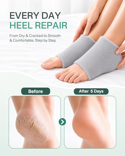 Originbuty Gray Moisturizing Heel Socks for Women & Men – Fuzzy Open-Toe Gel Heel Protectors