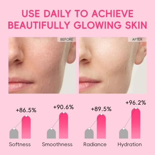 QUIYUM 14 Pack Watermelon Niacinamide Sheet Masks - Hydrating Facial Masks for All Skin Types
