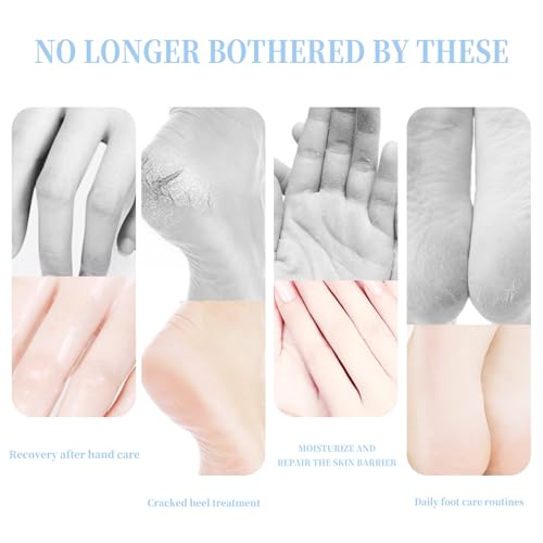 Moisturizing Foot Lotion Stick for Cracked Heels & Dry Skin