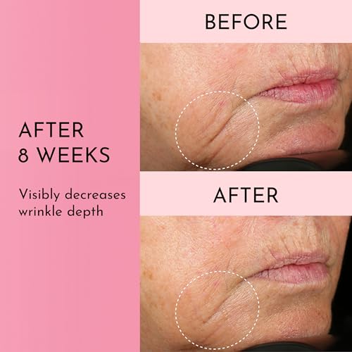Lawless Forget the Filler Skin-Plumping & Line-Smoothing Cream - 0.5 oz