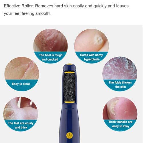 12 Pack Replacement Extra Coarse Rollers for Dr. Scholl's Callus Remover Foot File