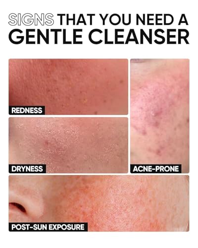SKINTIFIC Low pH Facial Cleanser with Hyaluronic Acid, 120ml