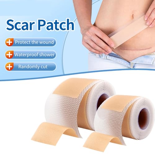 Medical-Grade Silicone Scar Sheets 1.6" x 157" Roll - Keloid, C-Section, Acne Treatment