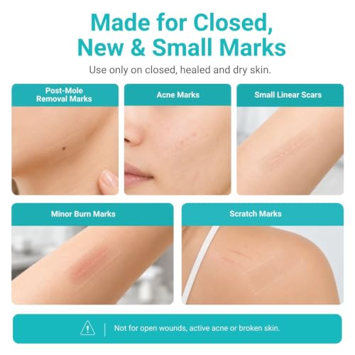 SCICOFIX Thin Silicone Scar Tape Roll for Face & Small Scars - 1.2"x120", 2 Rolls