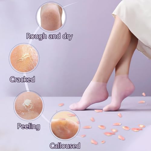 TEAWOO Moisturizing Silicone Heel Socks for Cracked Feet - 2 Pairs