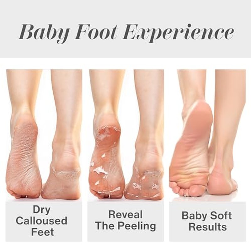 Baby Foot Original Exfoliation Foot Peel - For Rough Cracked, Dry Feet, Dead Skin Removal - Foot Peeling Mask for Baby Soft Feet - Spa Experience at Home & Gift Ideas - Lavender Scented