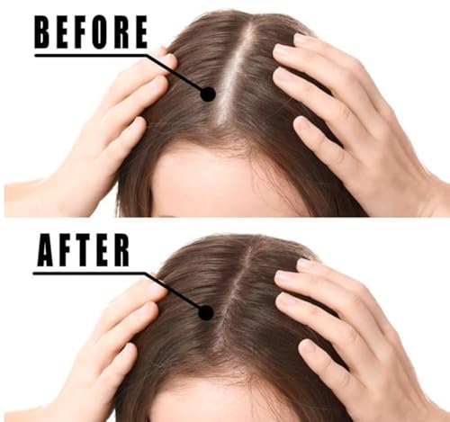 Hair Growth Spray for Stronger Hair & Beard – Natural DHT Blocker