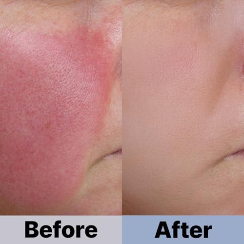 COSNOLOGY Hydrating Marine Collagen & Hyaluronic Acid Essence 150ml – Soothing Skincare for All Skin Types