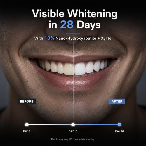 Woadee 10% Nano Hydroxyapatite Toothpaste - Fluoride-Free Whitening & Enamel Remineralization, 4.23oz