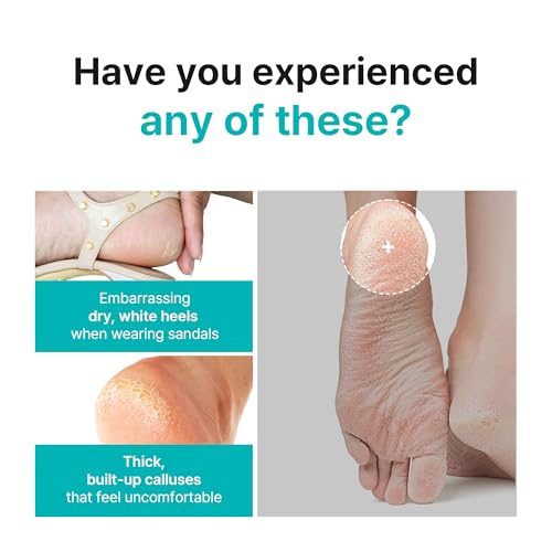 Ariul Smooth & Pure Exfoliating Foot Peel Mask - 2 Pairs with Aloe & Hyaluronic Acid