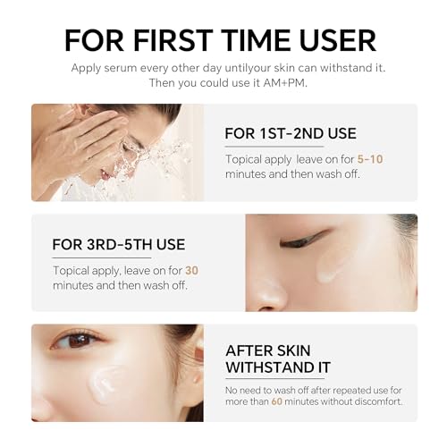 10% Azelaic Acid Serum for Acne, Rosacea & Redness Relief - 1.59oz
