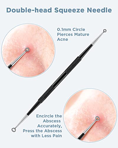 TAYTHI Double-Head Blackhead Remover Tool Kit - 5Pcs Stainless Steel Acne Extractor