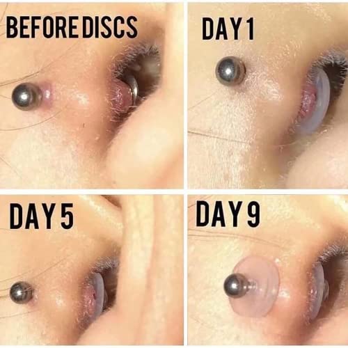 Bloomfall Clear Piercing Discs for Keloid Treatment - 120 pcs
