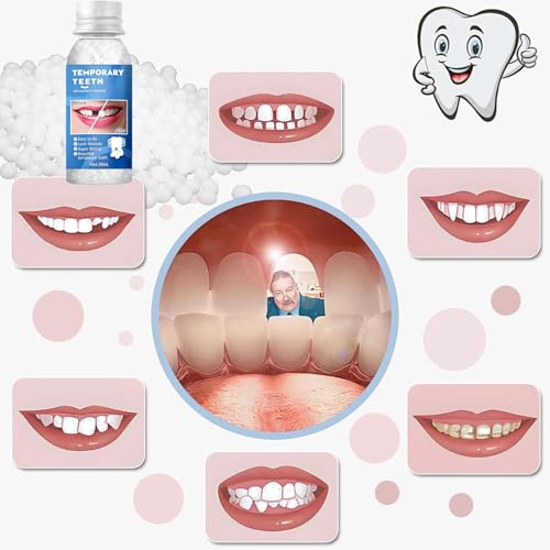 DIY Fake Tooth Repair Kit - Durable & Reusable Teeth Decoration