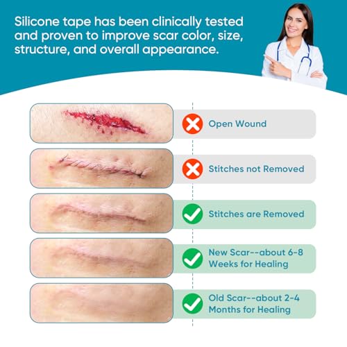 VPRIME SAFETYFY Medical-Grade Silicone Scar Tape 1.6"x 80" Roll-2M for Surgical, C-Section, Acne & Burn Scars