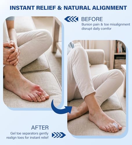 12 Pack Aloe Infused Gel Toe Separators for Bunion Relief