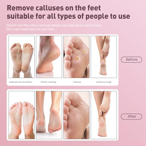 MUXUN Pink Mini 2-in-1 Rechargeable Electric Foot Callus Remover