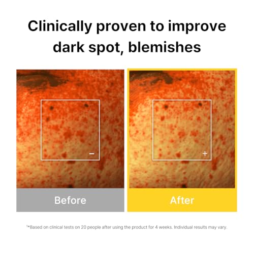 Cell Fusion C Toning Serum - Brightening Dark Spot Treatment with Vitamin C & Niacinamide, 1.01 fl. oz