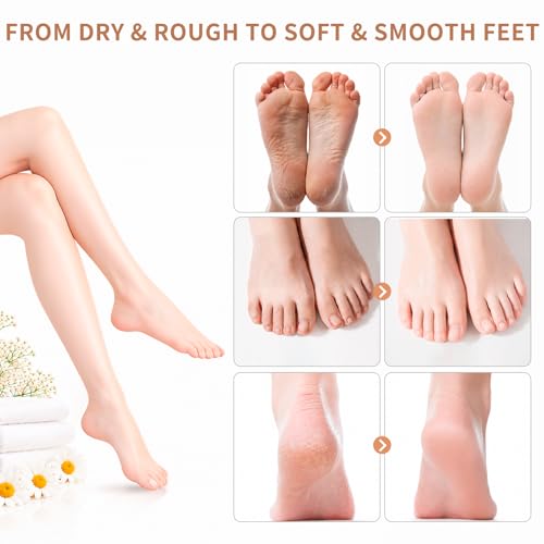 QUNGCO Moisturizing Foot Mask Socks – 8 Pack Hydrating Treatment for Dry Feet