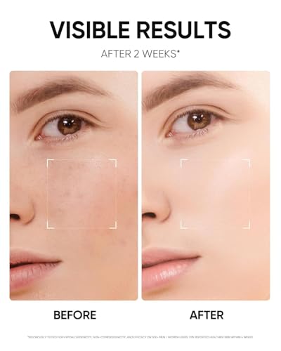 SKINTIFIC Niacinamide Brightening Moisturizer 50g – Hydrating Face Cream