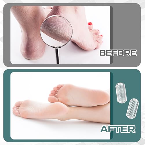 Moxweyeni 8 Pack Foot File Replacement Blades Stainless Steel for Pedicure | Silver