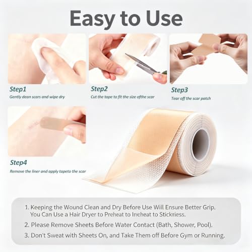 Anchiray Medical Grade Silicone Scar Tape Roll - 1.6" x 60" Waterproof