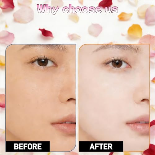 Neecio 10 Pack Face Masks Skincare Set - Hydrating & Rejuvenating for All Skin Types