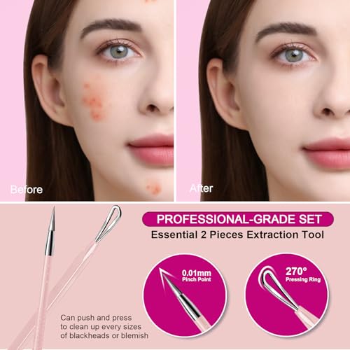 Teenitor 2-in-1 Blackhead Extractor Tool Kit for Clear Skin