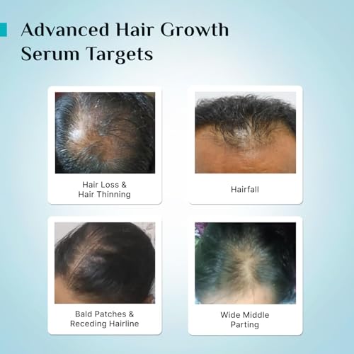 Pilgrim Hair Growth Serum 1.01 Fl Oz with Redensyl & Baicapil for Men & Women – Includes Pack of 1