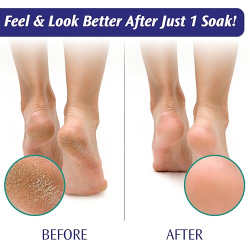 PediFix Epsom Salt Foot Bath Soaking Crystals with Tea Tree Oil - 6 Packets