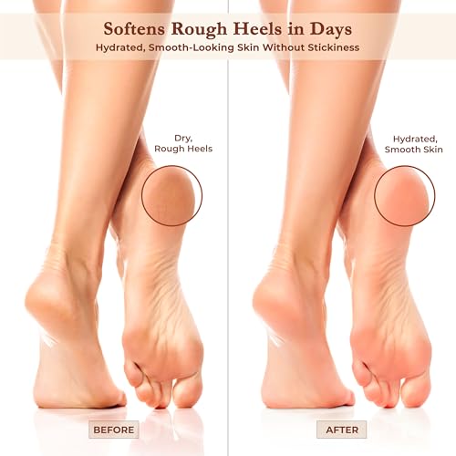 Argaviva Foot Cream for Dry Cracked Heels with Argan Oil & Shea Butter