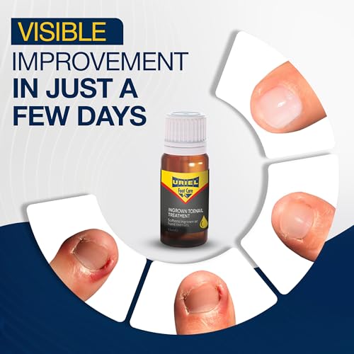 URIEL Ingrown Toenail Treatment Kit 0.37 fl oz - Home Nail Care & Softening Solution