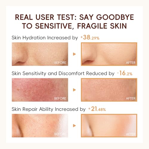 BEUKING Rice Face Cream - Long-Lasting Hydration & Firming