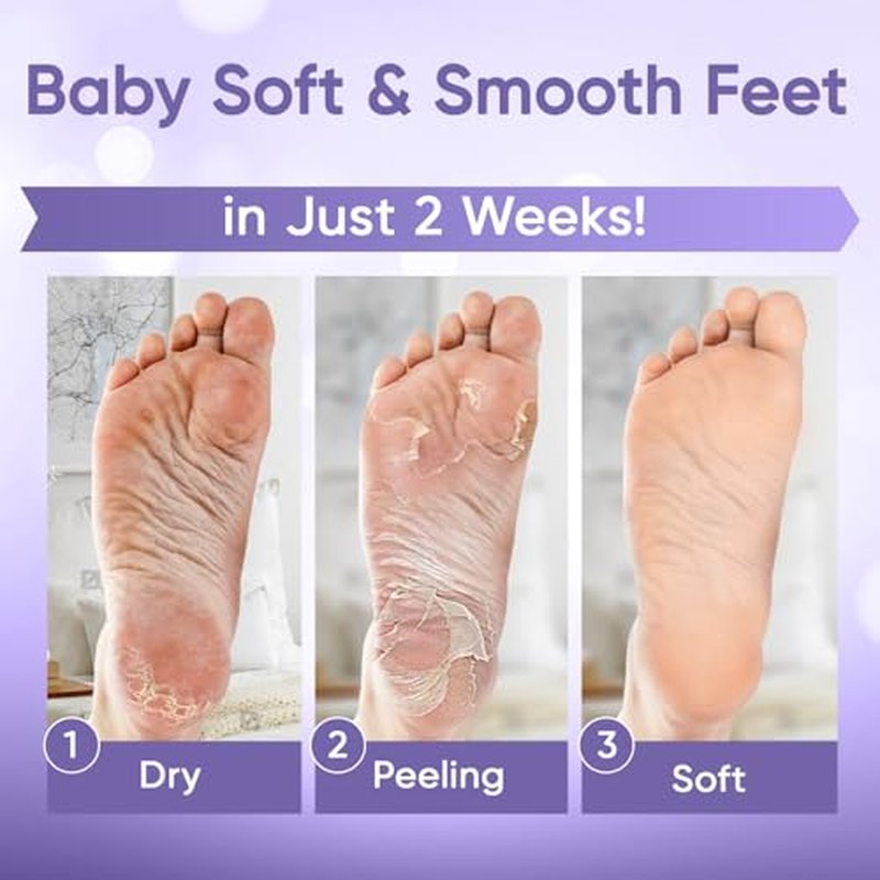 C?LOR Foot Peeling Mask for Dry Cracked Feet | Foot Mask to Exfoliate Rough, Cracked, Dry Feet, Calluses for Soft Baby Feet Results | Made with Aloe Vera Extract for Women & Men (2 Pairs) | Lavender