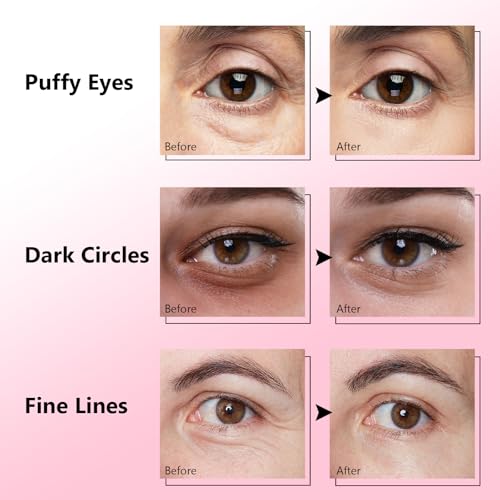 Jakuva Pink Caffeine Eye Patches Set - 60 Count Under Eye Masks for Dark Circles & Puffiness