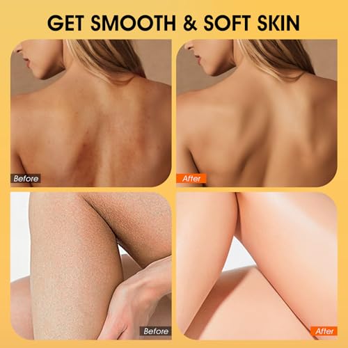 VOERUY Turmeric Exfoliating Body Scrub with Coconut Oil & Vitamin C - 11.28oz