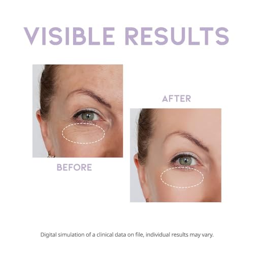 #OOTD Vegan Eye Cream for Dark Circles and Puffiness, 0.85 fl oz