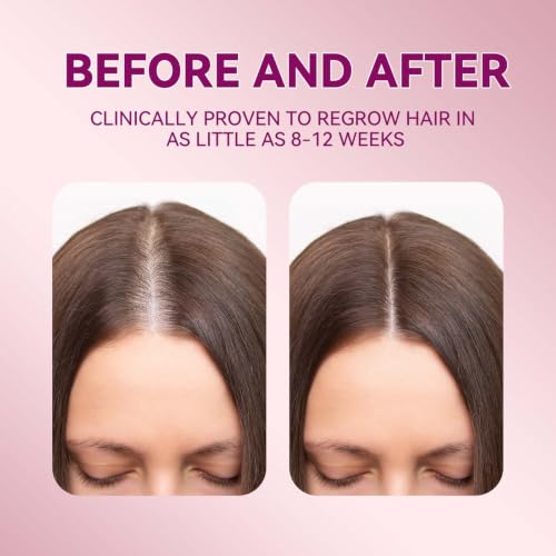 Lavtek 5% Minoxidil Hair Growth Serum for Women - Biotin & Castor Oil, 2 Pack