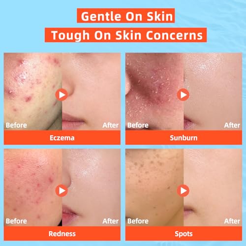 dewyhour Hypochlorous Acid Face Mist - Soothing pH-Balanced Skin Toner