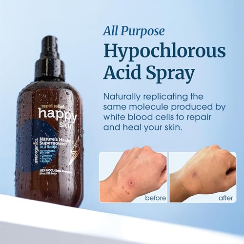 Era Organics HOCL Face and Body Toner Spray – Hypochlorous Acid 0.02%