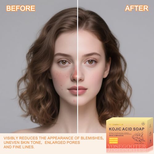 Turmeric Kojic Acid Soap Bar for Dark Spots & Moisturizing