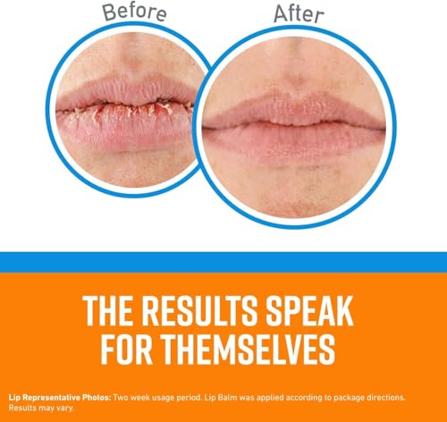 O'Keeffe's Lip Repair Cooling Relief Balm - 3 Pack, 0.15 oz Each